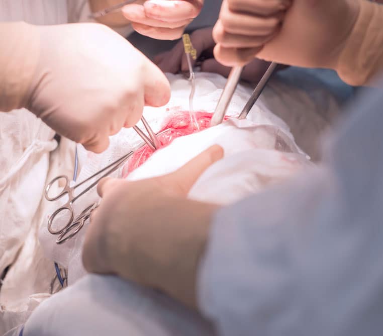 surgical-supply-slr-medical-consulting